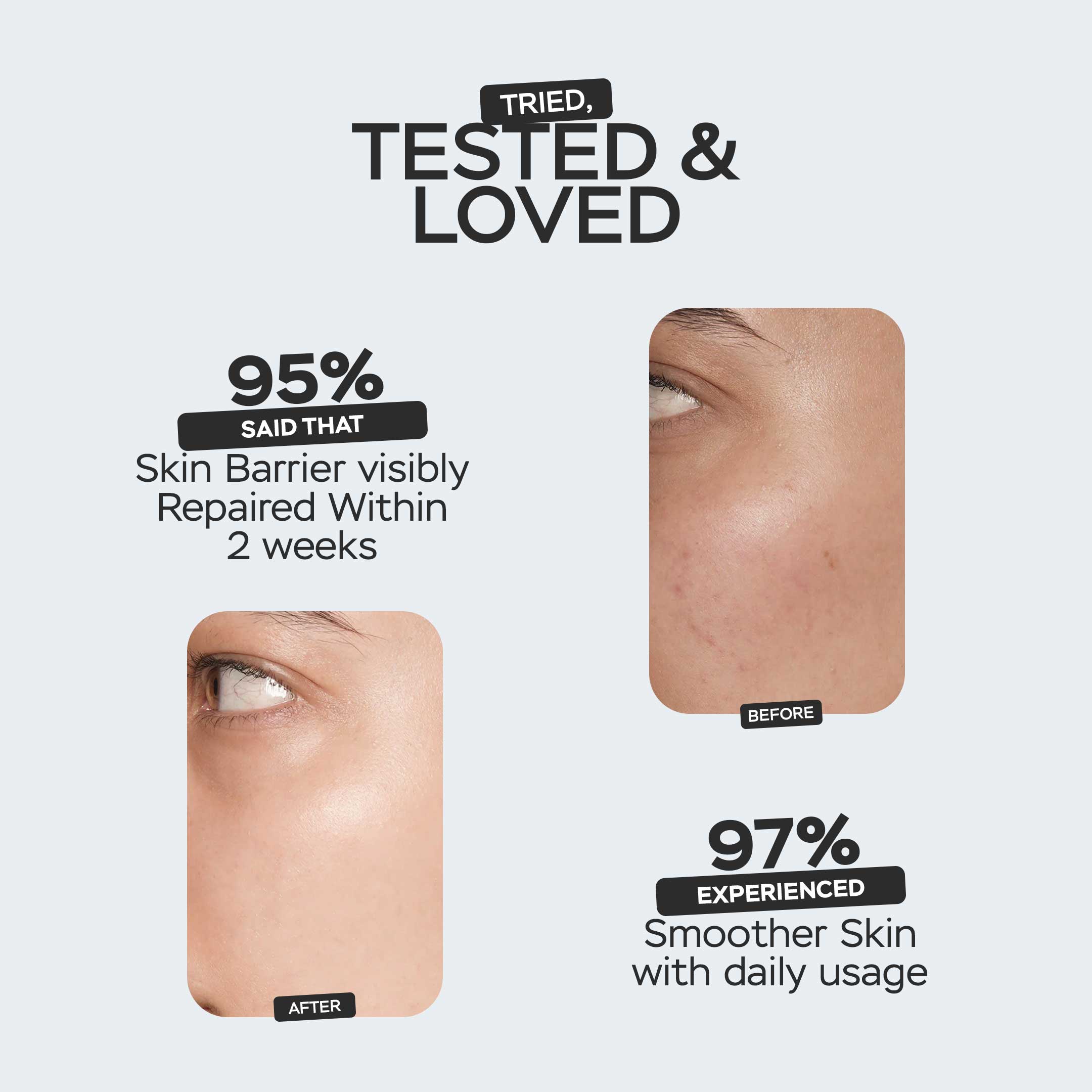 How to Achieve Korean Glass Skin: The Ultimate Guide to Glowing, Dewy Skin